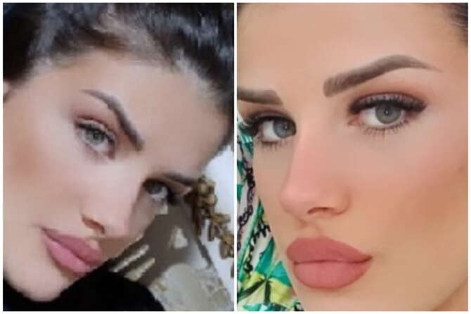 Chi è Alessia Neboso la 21enne deceduta dopo un intervento al seno a Napoli