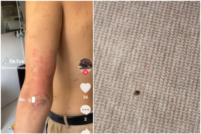 Cosa sono le cimici da letto: punture, cause, rimedi all’infestazione che allarma la Francia e preoccupa l’Italia