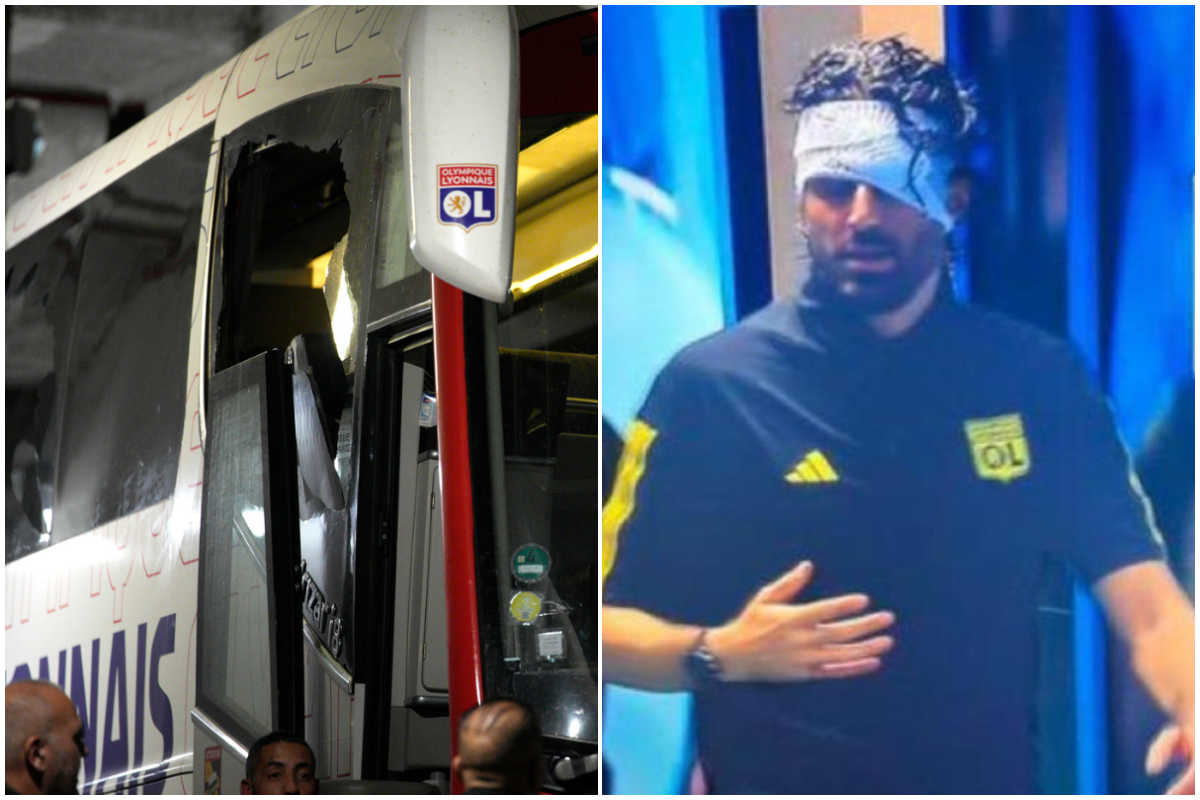 Francia sconvolta da Marsiglia-Lione, sassaiola contro il pullman: Fabio Grosso ferito, partita annullata, 7 arresti