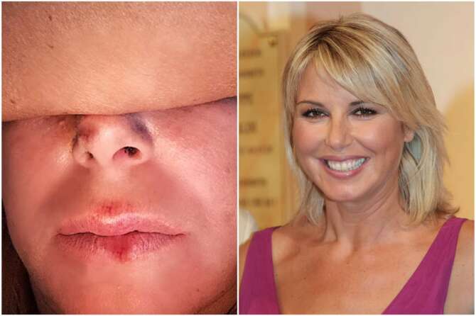 Monica Leofreddi: incidente stradale per la conduttrice