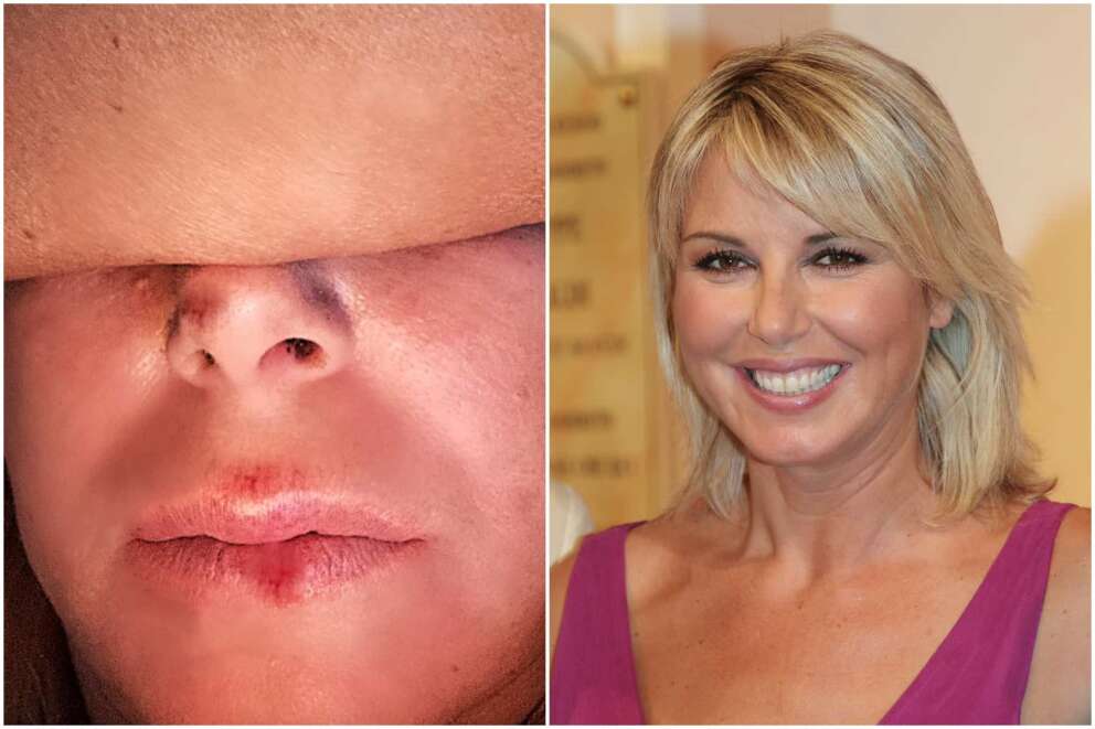 Monica Leofreddi: incidente stradale per la conduttrice