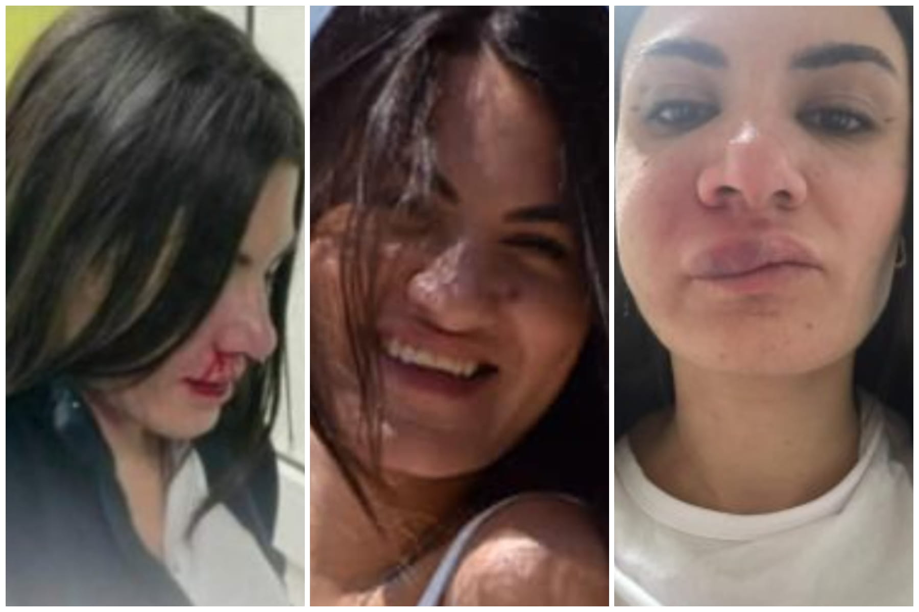 Picchiata nel pronto soccorso di Castellammare, chi ha aggredito l'infermiera Anna Procida