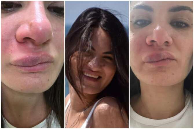 Anna Procida: chi è l’infermiera picchiata nell’ospedale di Castellammare di Stabia