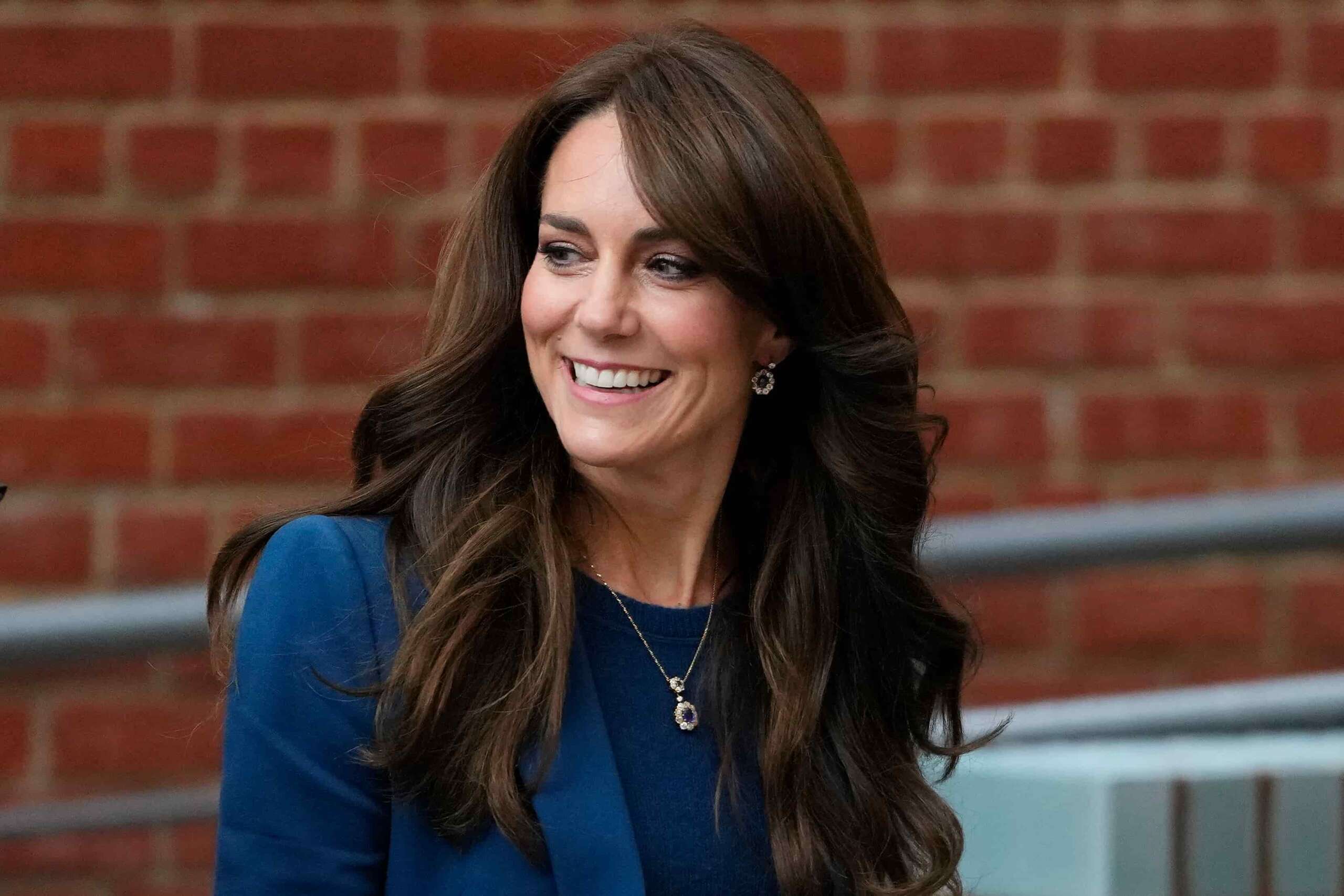 Cosa è la divercolite, la patologia che avrebbe la principessa Kate