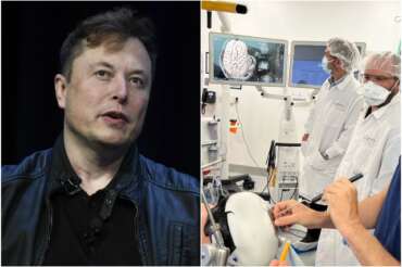 Cos’è Neuralink, come funziona l’impianto installato per la prima volta su un essere umano: cosa fa il chip di Musk