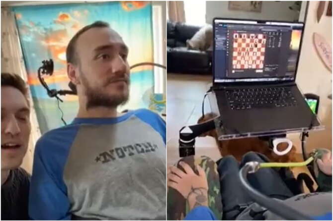 Noland Arbaugh, il primo uomo a sottoporsi all’operazione per impiantarsi il chip di Neuralink