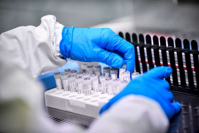 Cosa è MIP-C, la malattia autoimmune legata al Covid-19: i sintomi, è potenzialmente mortale