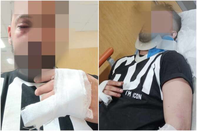 Napoli, picchiato davanti a moglie e figli da un parcheggiatore abusivo che voleva 50€