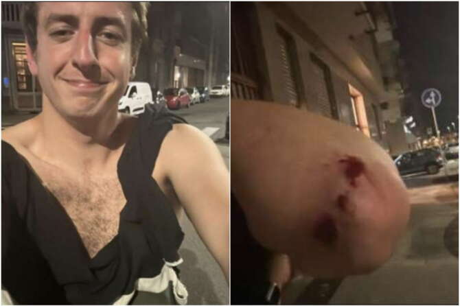 Andrea Joly, il giornalista de La Stampa aggredito a Torino