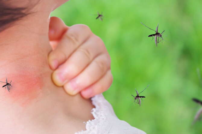 Zanzare, chi le attira di più e perché: come difendersi dalle punture. I consigli per l’estate