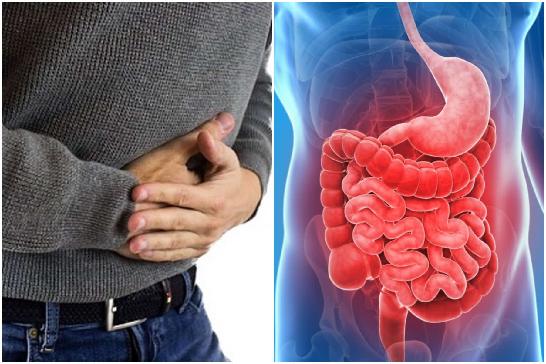 Morbo Chron: di cosa si tratta, i sintomi e la cura. Può essere fulminante e causare invalidità? Cosa mangiare per la dieta e rischi per i bambini