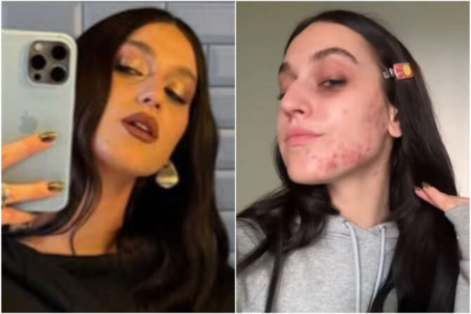 Fonte profilo Instagram