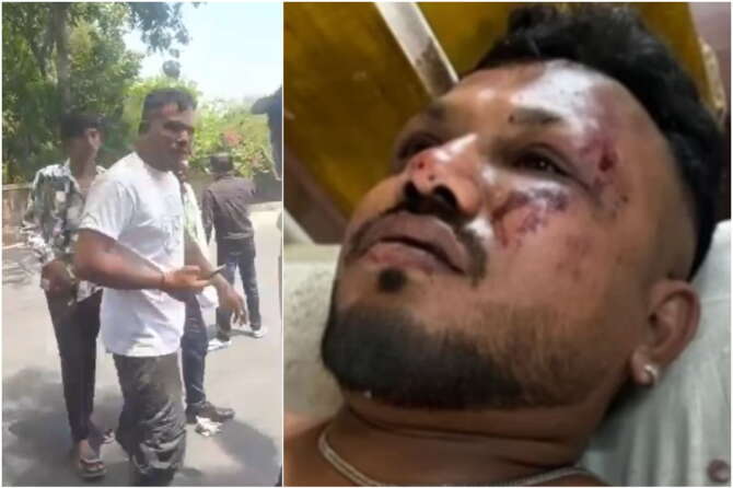 Chi è l’unico sopravvissuto al disastro aereo in India: il “miracolo” di Vishwash, scampato alla strage