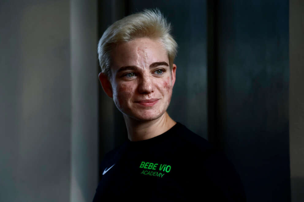 Bebe Vio lascia la scherma, l’atleta paralimpica cambia sport e passa all’atletica: “Mi stavo distruggendo”